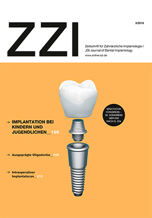 Cover ZZI
